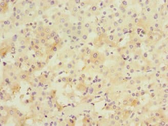 PPM1D / WIP1 Antibody