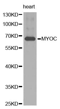 Polyclonal Rabbit anti-Human MYOC / Myocilin Antibody (IHC, WB)