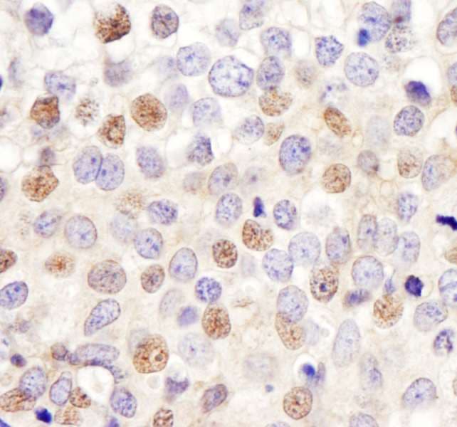 HURP / DLGAP5 Antibody (aa200-250)