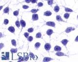 IHC-plus™ Polyclonal Rabbit anti-Human NPY5R Antibody (Cytoplasmic Domain, IHC)