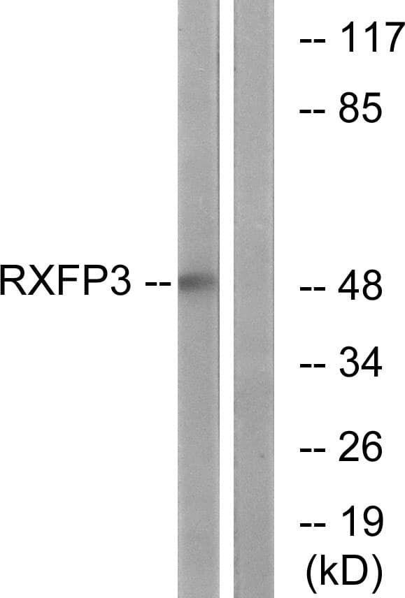 RXFP3 Antibody (aa161-210)