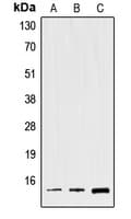 TFF2 / SP Antibody (Internal)