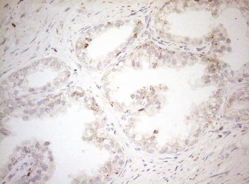 DECR1 Antibody (clone OTI5D12)