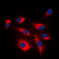 CASP6 / Caspase 6 Antibody (Internal)