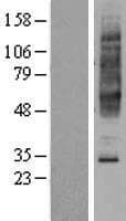 NPBWR2 / GPR8 Protein (Over-Expression Lysate Myc-DDK (Flag))