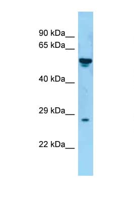 CD30L / CD153 Antibody (aa55-104)
