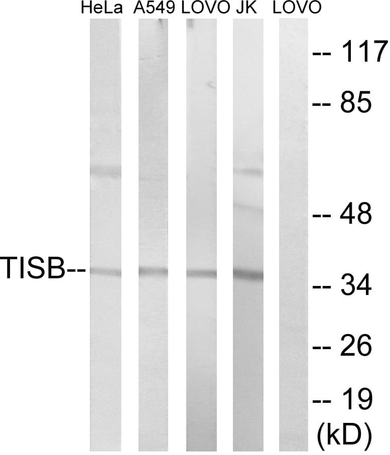 IHC-plus™ ZFP36L1 Antibody (aa58-107)