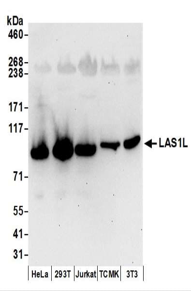 LAS1L Antibody (aa684-734)