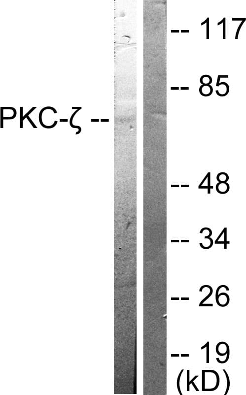 IHC-plus™ Polyclonal Rabbit anti-Human PRKCZ / PKC-Zeta Antibody (aa376-425, IHC, IF, WB)