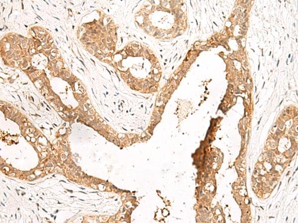 LDHA / LDH1 Antibody