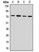 PCK2 / PEPCK Antibody