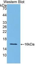 IL12RB2 Antibody (aa559-647)