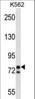 PCSK7 / PC7 Antibody (aa692-721)