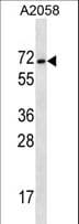 Polyclonal Rabbit anti-Human MAGEE2 Antibody (aa485-513, WB)