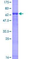 Human HIF1AN Protein (Recombinant GST)