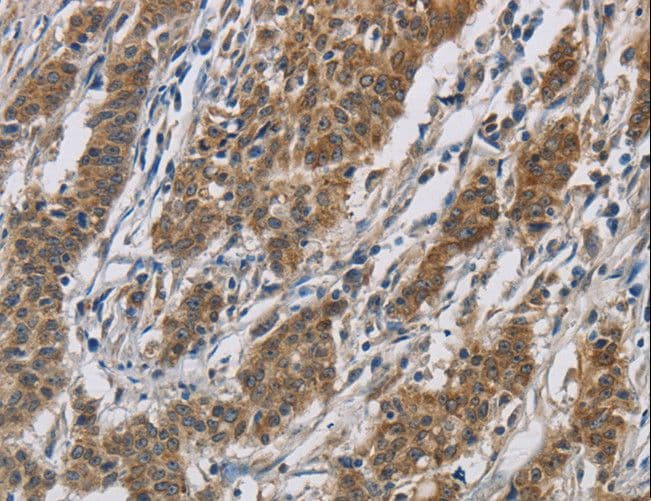 Polyclonal Rabbit anti-Human OPRS1 / SIGMAR1 Antibody (IHC, WB)