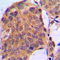 ERK1 + ERK2 Antibody (C-Terminus)