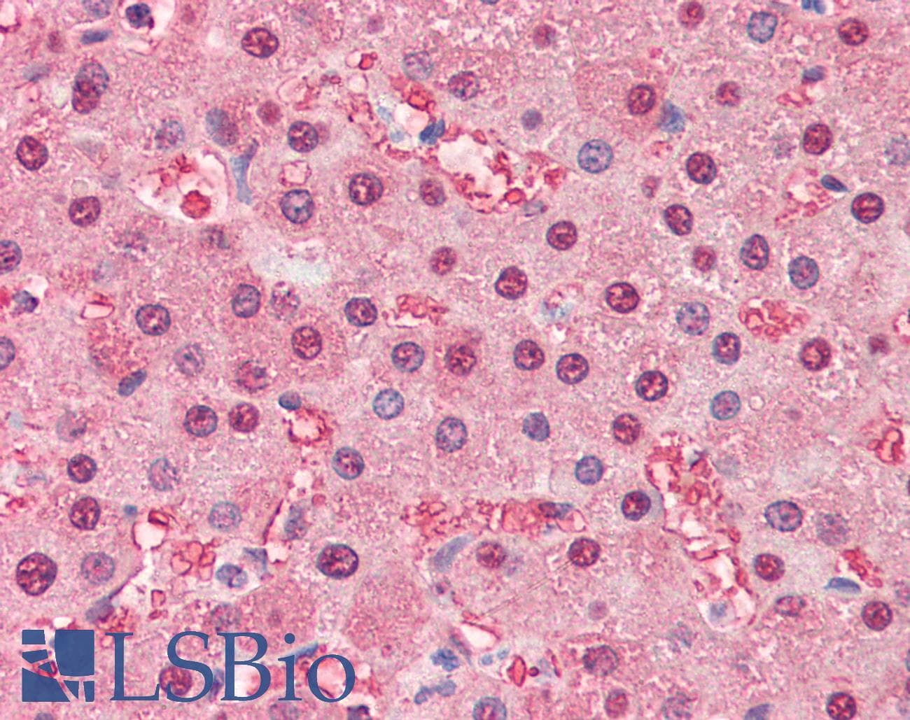 IHC-plus™ FABP1 / L-FABP Antibody (aa1-127, clone 2G4)