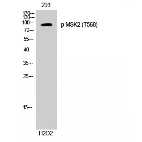 Polyclonal Rabbit anti-Human RPS6KA4 / MSK2 / RSK-B Antibody (500-580 aa, IHC, WB)