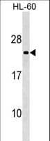MS4A8 / MS4A8B Antibody (aa44-70)