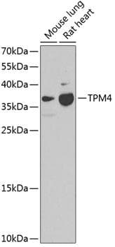 TPM4 Antibody