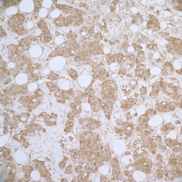 HSPB1 / HSP27 Antibody (aa150-200)