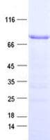 Human ZNF285 / ZNF285A Protein (Recombinant His, N-Terminal)