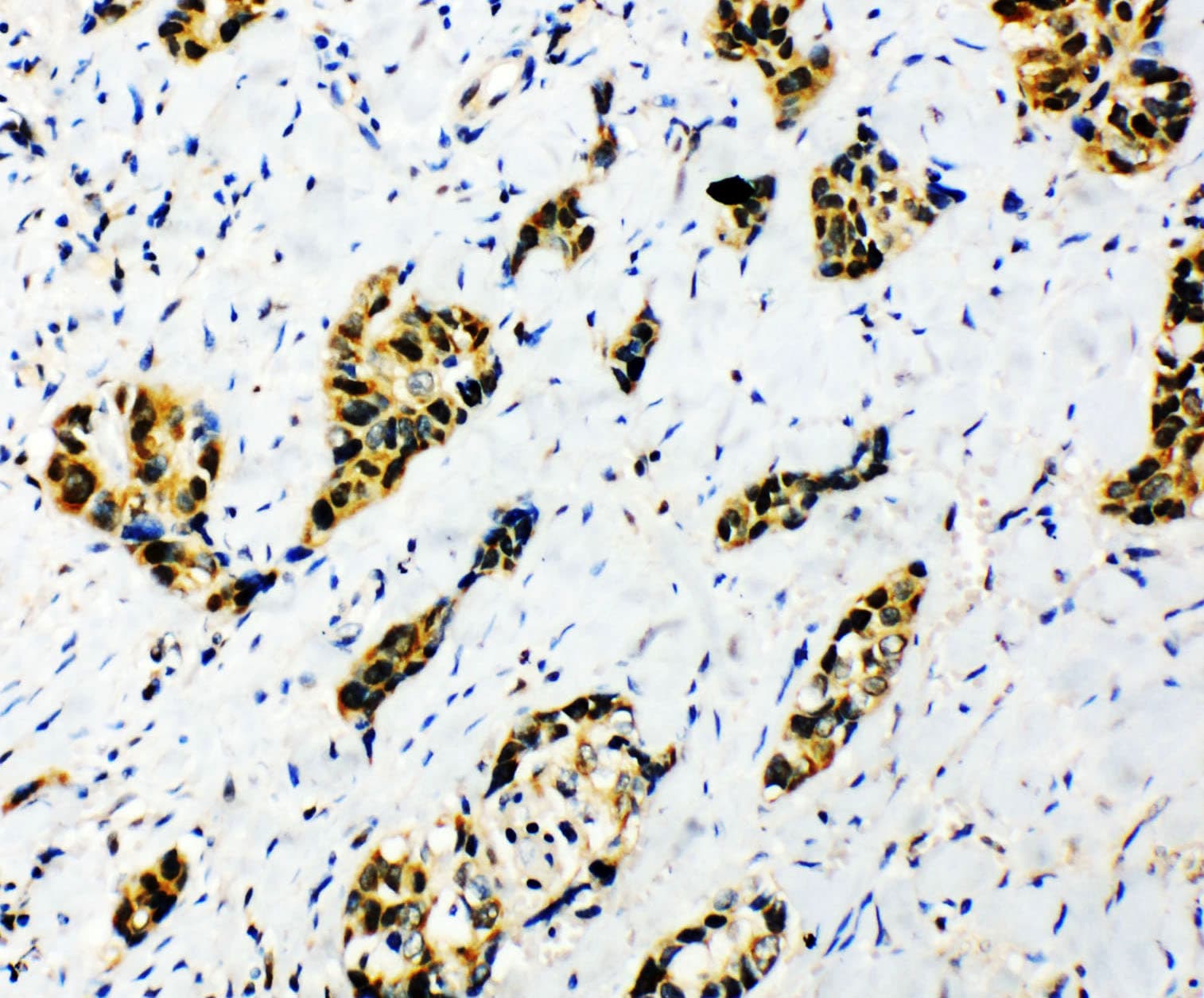 SF1 Antibody (aa11-30)