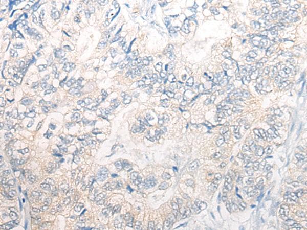 Polyclonal Rabbit anti-Human PNPO Antibody (IHC, WB)
