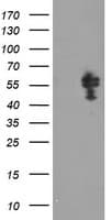 Monoclonal Mouse anti-Human NONO / P54NRB Antibody (clone OTI2E7, IHC, WB)