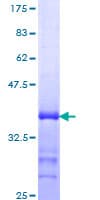 Human GFI1 Protein (Recombinant GST, N-terminus)