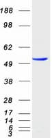 Human ENTPD6 Protein (Recombinant Myc-DDK (Flag))