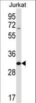 HRASLS5 Antibody (aa100-129)