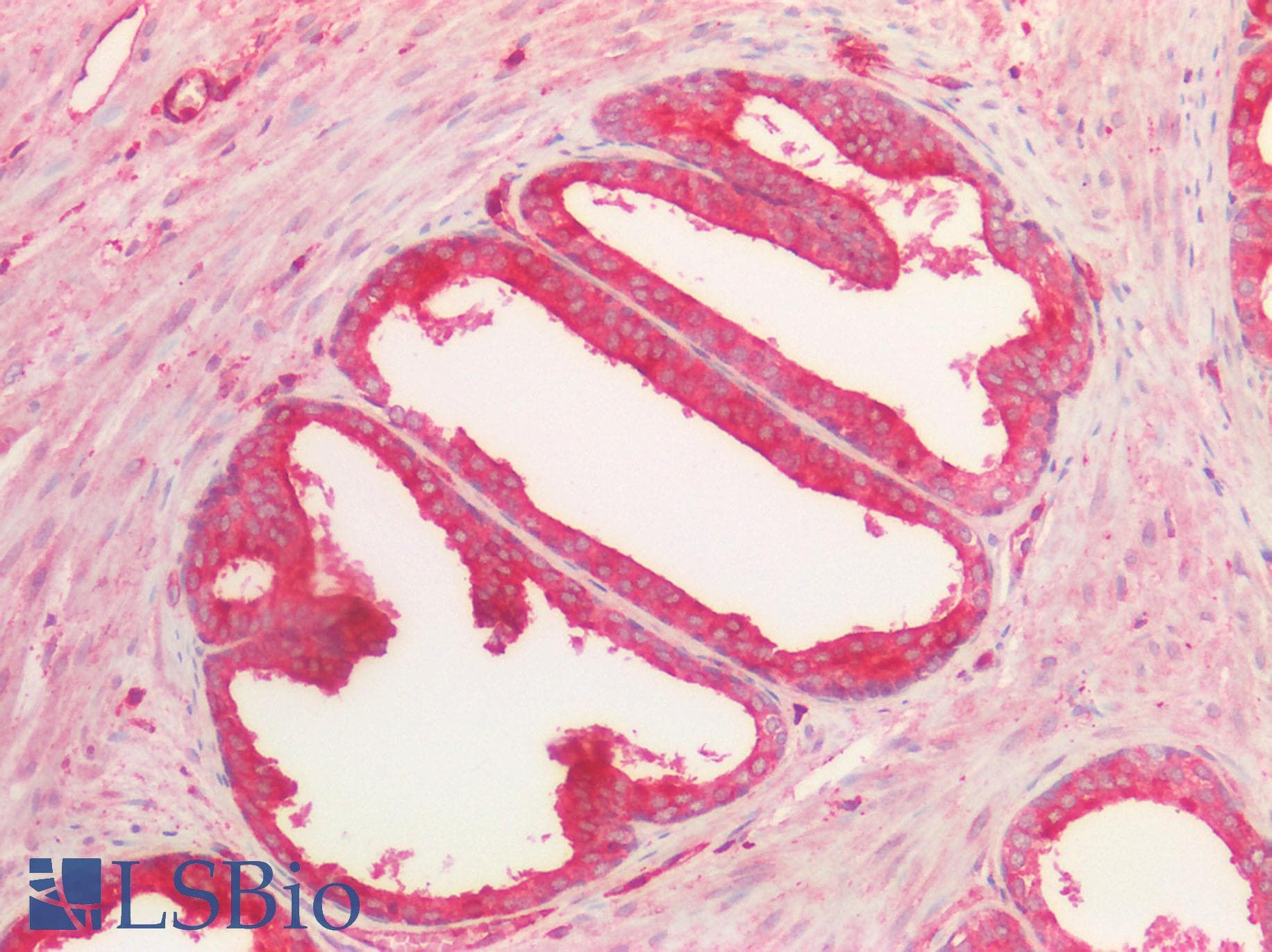 ROR2 Antibody