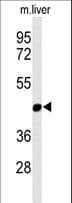 Polyclonal Rabbit anti-Human MMAA Antibody (aa56-84, IHC, WB)
