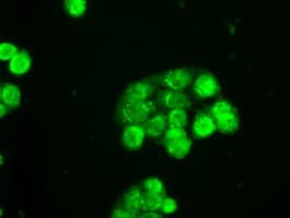 SLC2A5 / GLUT5 Antibody (clone OTI12F2)