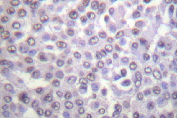 Histone H4 Antibody (Lys5)
