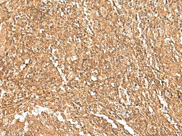 Polyclonal Rabbit anti-Human GTF3A Antibody (IHC)