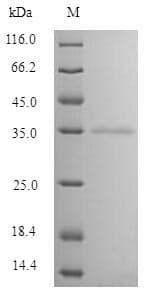 Cow MBL Protein (Recombinant DDK,C-terminus)