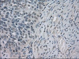 SLC2A5 / GLUT5 Antibody (clone OTI11D11, Carrier-free)