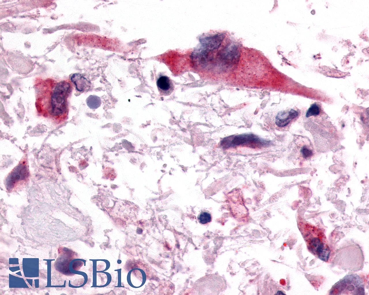 PathPlus™ Polyclonal Rabbit anti-Human PGR1 / GPR153 Antibody (C-Terminus, IHC)