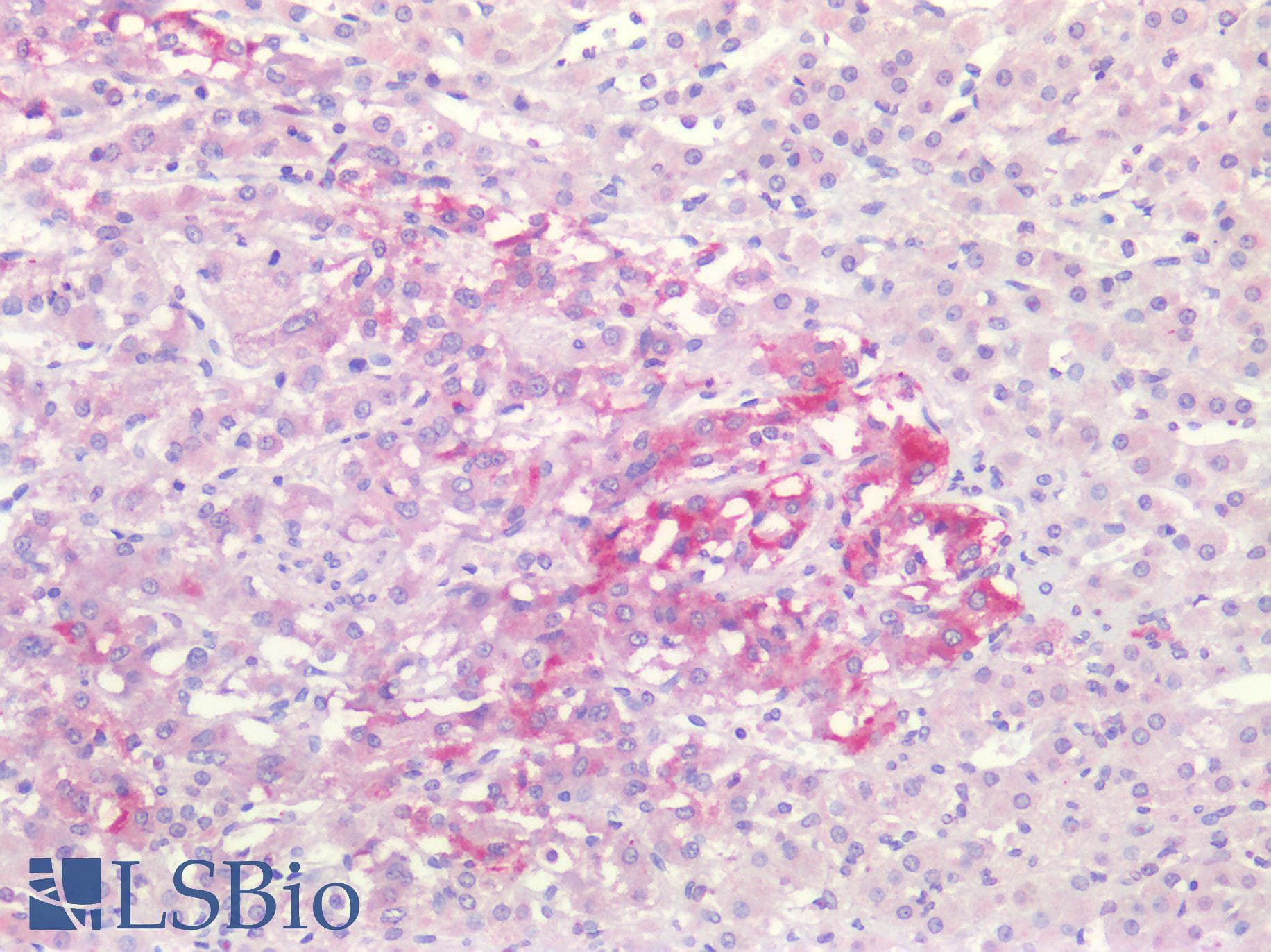 PathPlus™ SEMA3B / SemA Antibody (aa100-200)