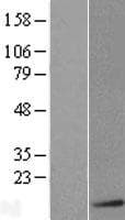 S100B / S100 Beta Protein (Over-Expression Lysate Myc-DDK (Flag))