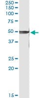 Monoclonal Mouse anti-Human PRKX Antibody (clone 1H7, WB)