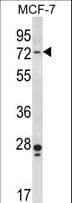 IHC-plus™ PAK4 Antibody (aa187-216)