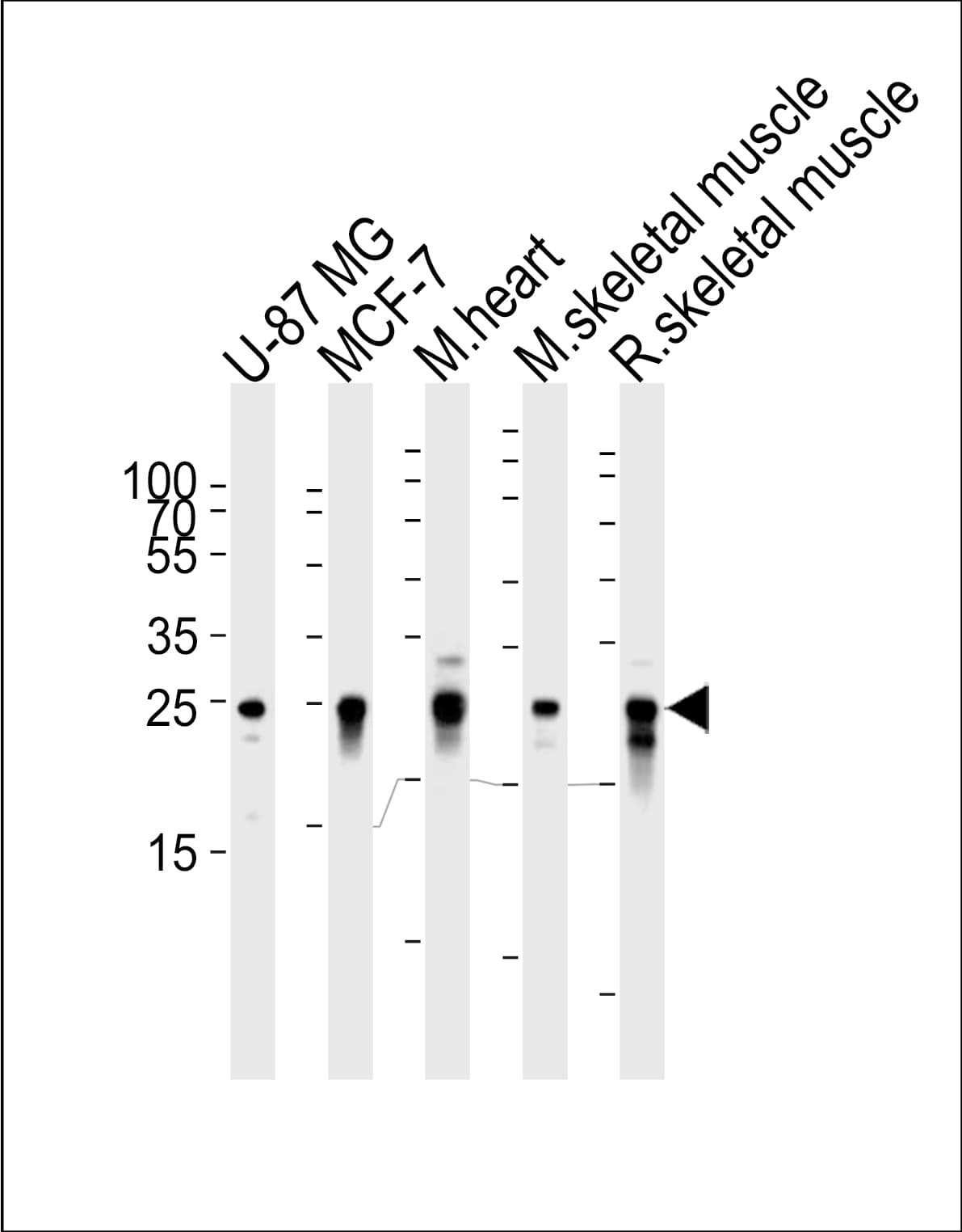 CRYAB / Alpha B Crystallin Antibody (clone 1329CT523.140.120)