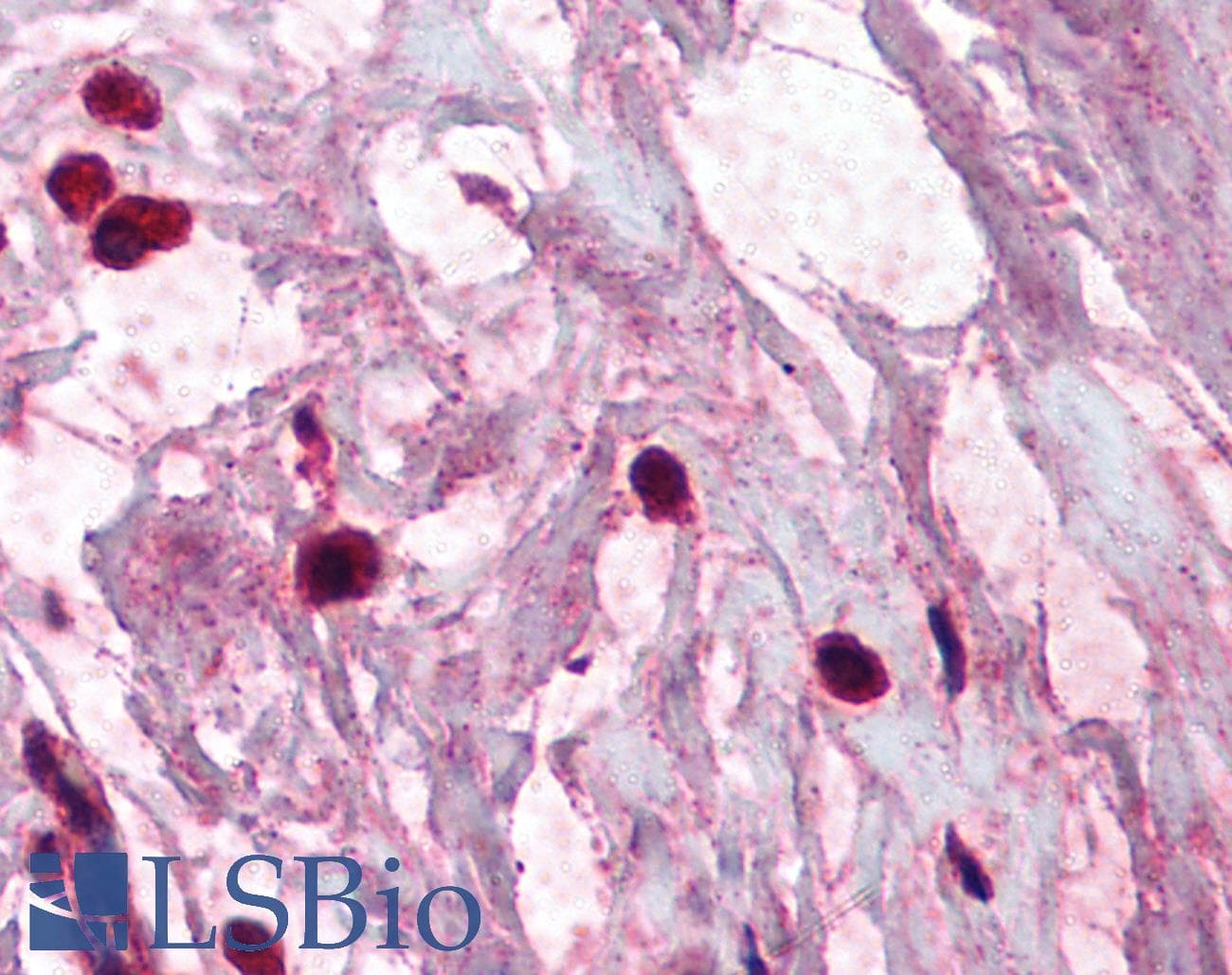 IHC-plus™ Monoclonal Mouse anti-Human TPSAB1 / Mast Cell Tryptase Antibody (clone AA1, IHC, IF)
