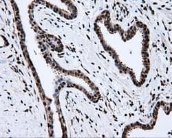 Monoclonal Mouse anti-Human TLDC1 / KIAA1609 Antibody (clone OTI5D9, IHC, IF, WB)