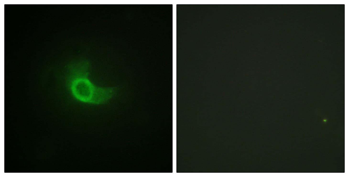 Polyclonal Rabbit anti-Human IL6ST / CD130 / gp130 Antibody (aa748-797, IHC, IF, WB)