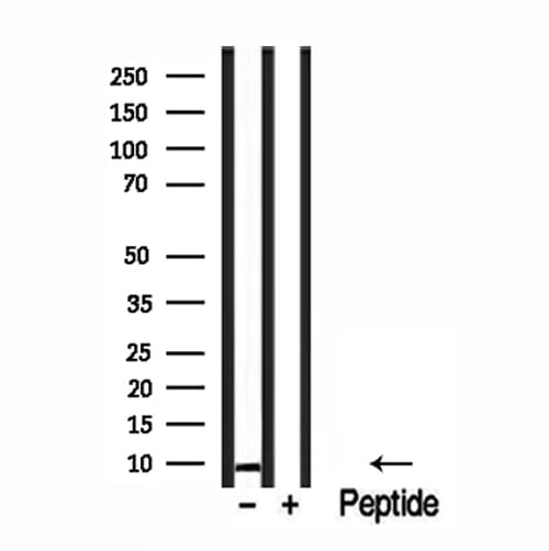 KFYI / NDUFC1 Antibody